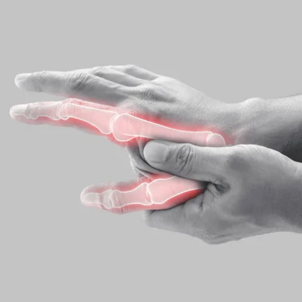 Rheumatology Rheumatology