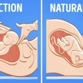 c section or natural c section or natural